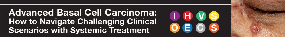 Advanced Basal Cell Carcinoma: How to Navigate Challenging Clinical Scenarios with Systemic Treatment