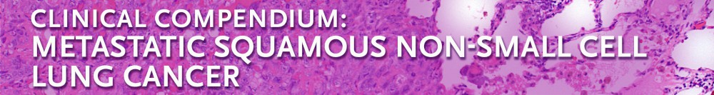 A Clinical Compendium: Metastatic Squamous Non-Small Cell Lung Cancer