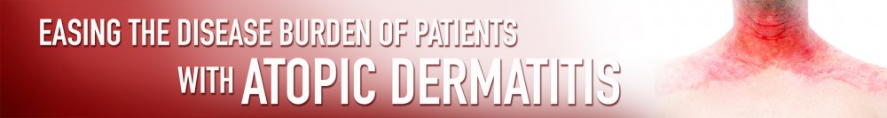 Easing the Disease Burden of Patients With Atopic Dermatitis