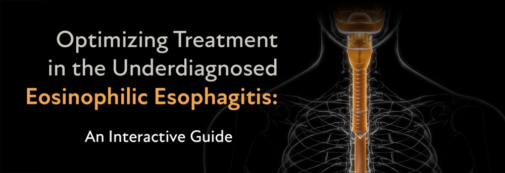 Optimizing Treatment in the Underdiagnosed Eosinophilic Esophagitis (EoE): An Interactive Guide
